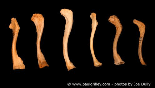 Human Variations in the Clavicle Human Variations in the Clavicle