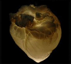 The heart, shown here with all the cells washed away, contains a scaffold of connective tissues.