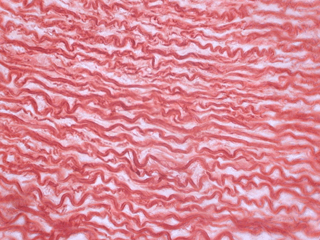 Figure 4: Collagen fibers are wavy