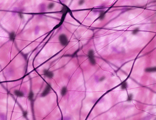 Figure 2: Fibroblasts in the web of fascia