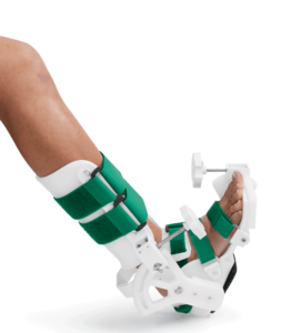 The JAS Ankle system utilizes Static Progressive Stretch to achieve permanent restoration of joint ROM in three 30-minute sessions per day.